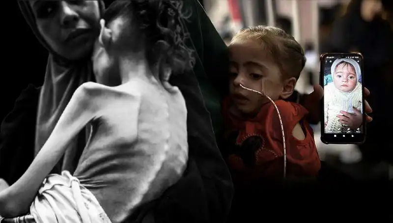 Düşüş Yaşayan Küçük Meryem’in Açlıkla Mücadelesi: 25 Kilo’dan 10 Kilo’ya
