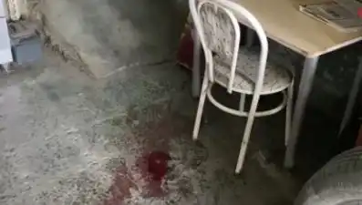 Sandalyeden Düşerek Hayatını Kayıp Ne Olacağını Biliyor Muydunuz?