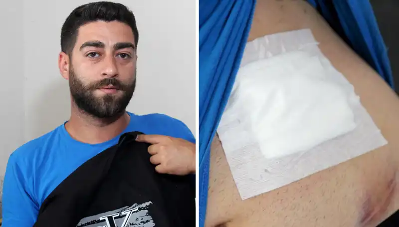 Karnındaki Ağrının Sebebi Röntgende Ortaya Çıktı: Şok Edici Sonuçlar