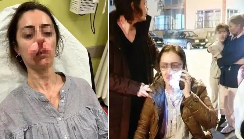 Otomobil Kapısı Silah Sayıldı: Eşinin Sevgilisi Sandığı Kişiye Saldırı!