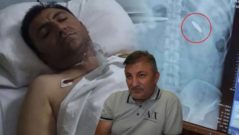 15 Temmuz'un Ardında Kalan Yaralar: 9 Yıldır Vücudu Kurşunla Mücadele Ediyor